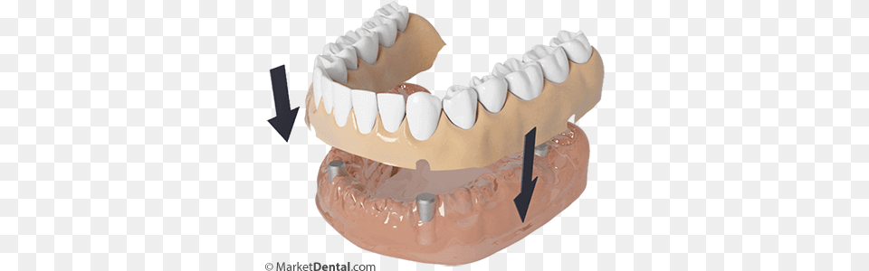 Dentures Edmonton Buttercream, Birthday Cake, Person, Mouth, Food Png Image