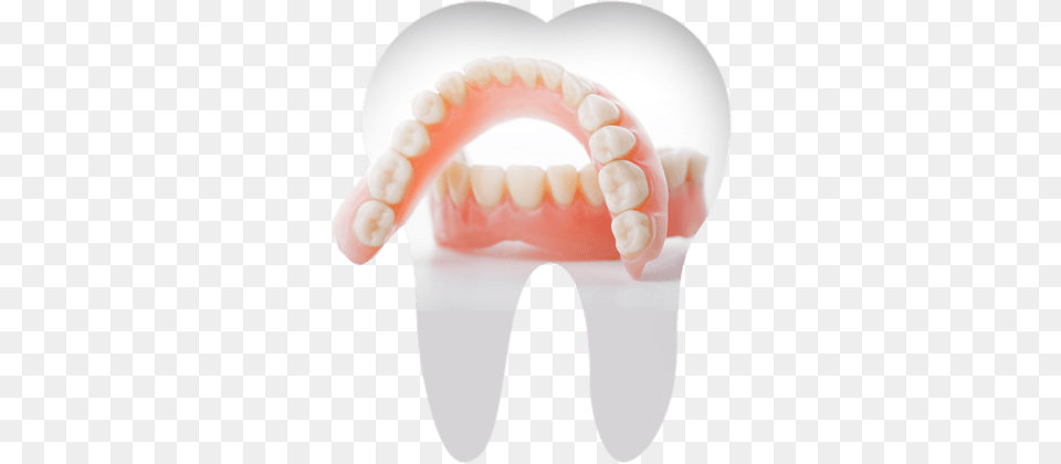 Dentures Orlando Desai Dental New Dentures, Body Part, Mouth, Person, Teeth Free Transparent Png