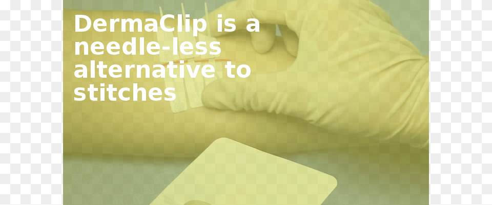 Dermaclip Is A Needle Less Alternative To Stitches Comfort, Clothing, Glove Png