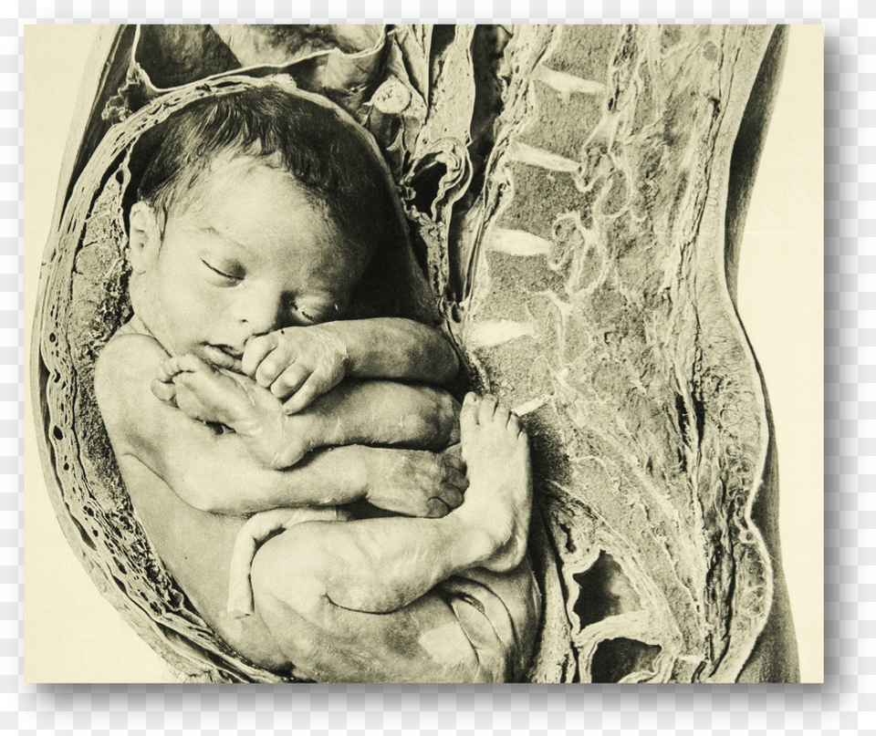 Detail Near Full Term Fetus Placed With Anatomical Anatomy, Face, Head, Person, Photography Png Image