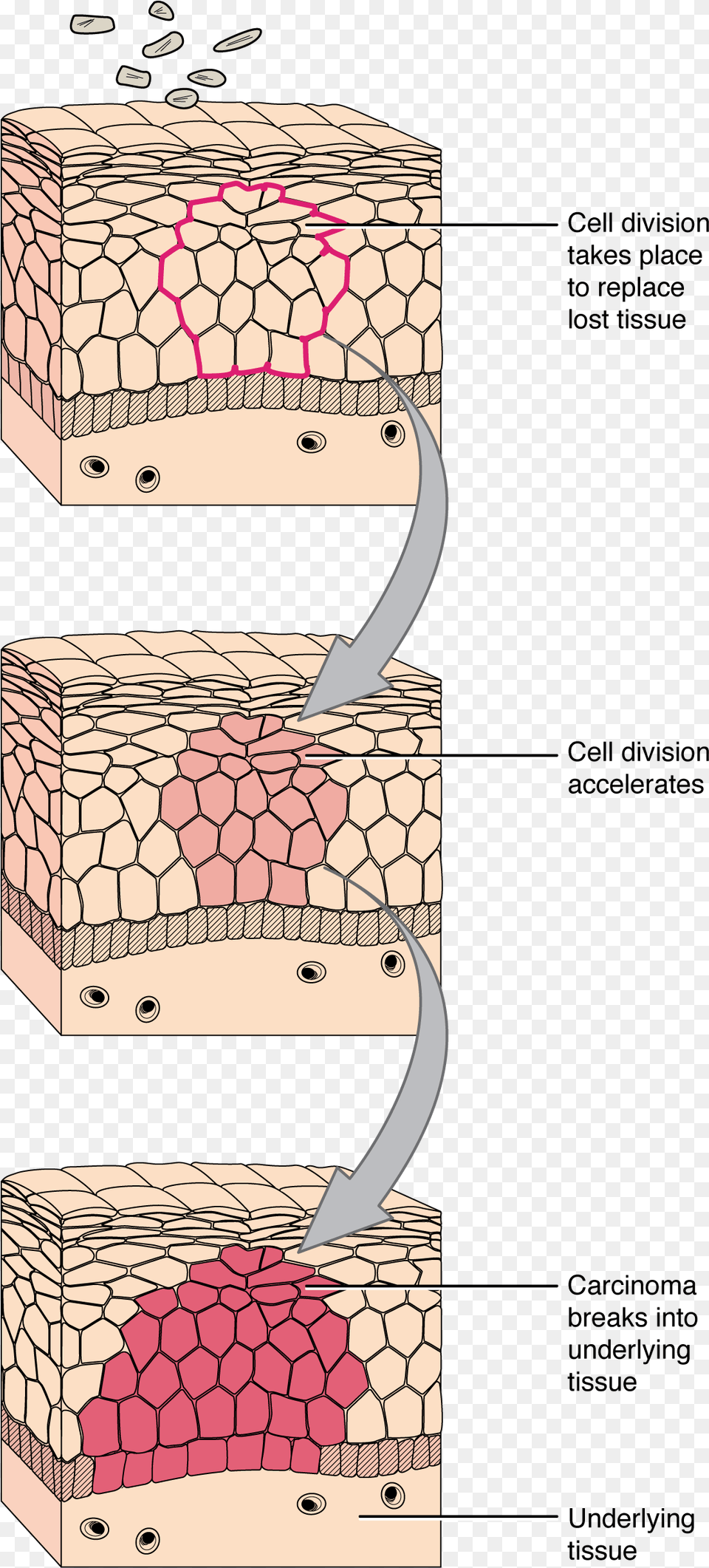 Development Of Cancer Tissue And A Cell Diagram, Treasure, Box Png