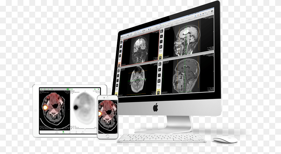 Devices Osirix Pacs Server, Ct Scan, Computer, Pc, Electronics Png Image