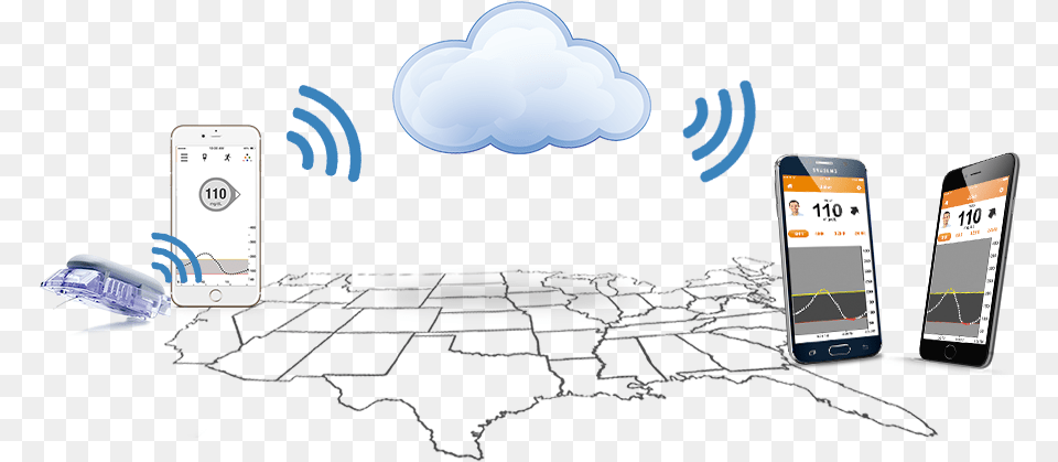 Dexcom Share Information Dexcom Share, Electronics, Mobile Phone, Phone Free Png