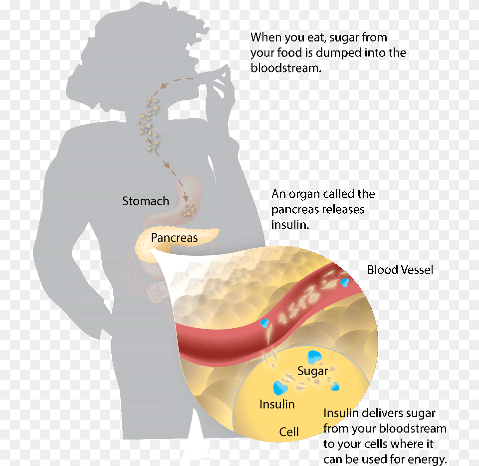 Diabetes Genetics, Adult, Female, Person, Woman Png