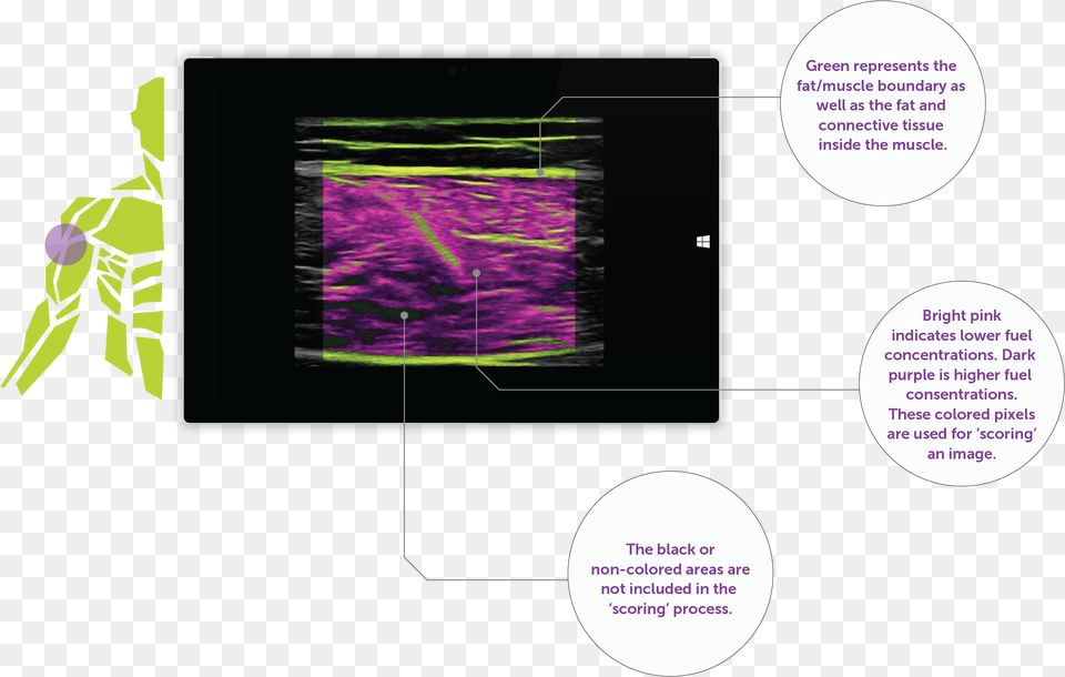 Diagram, Purple, Ct Scan, Adult, Person Png Image