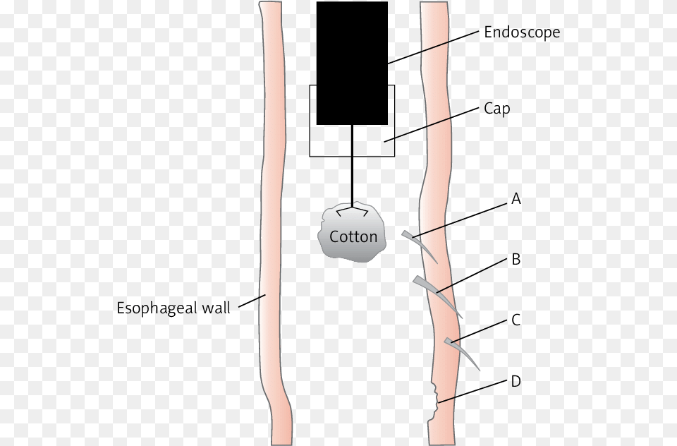 Diagram, Chart, Plot, Bow, Weapon Free Png