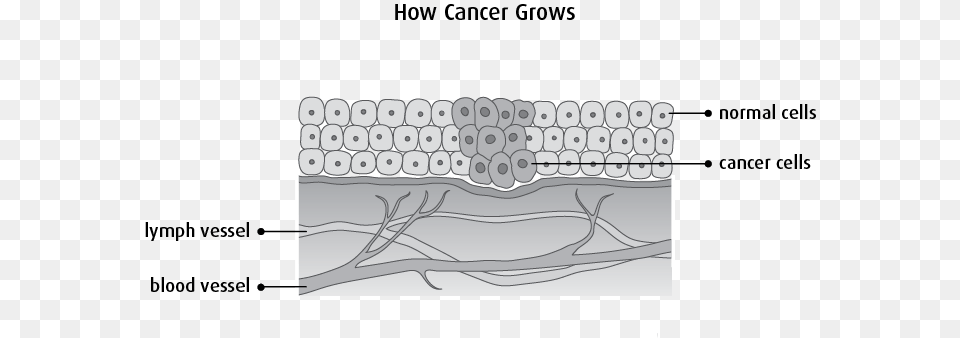 Diagram Of How Cancer Grows Diagram Free Png