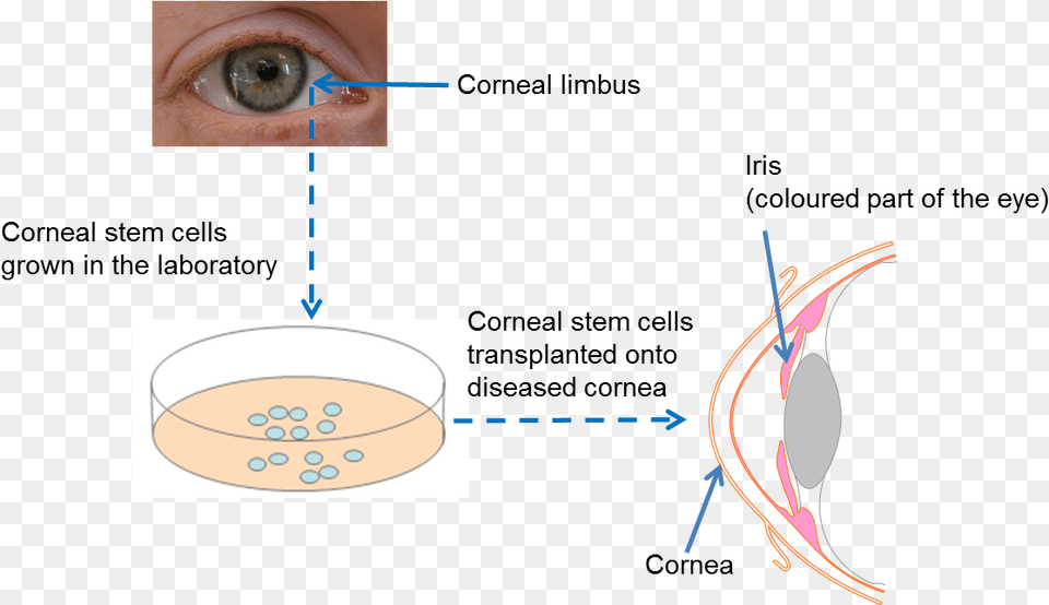 Diagram On Repairing The Cornea Stem Cell In Eye, Face, Head, Person, Baby Free Png
