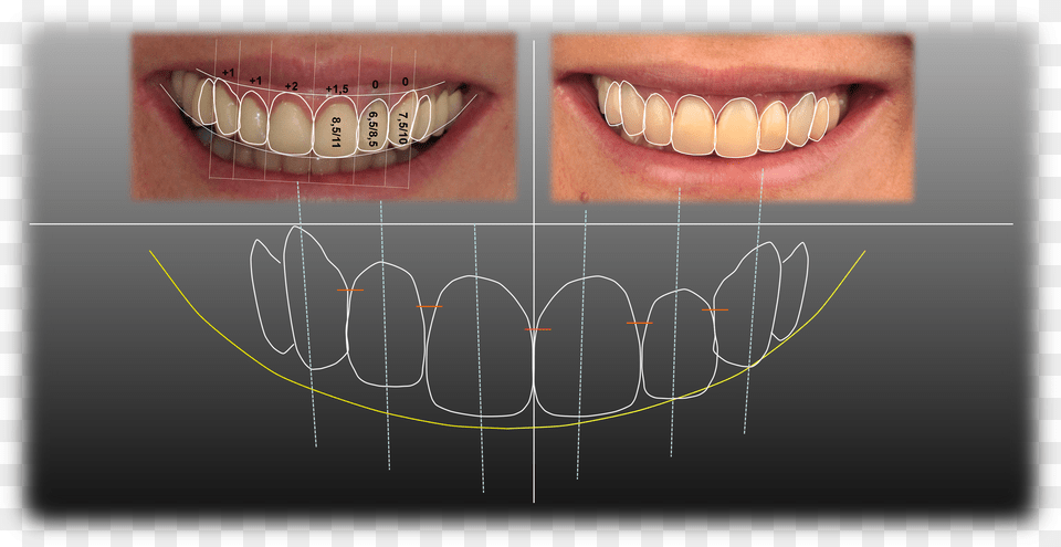 Digital De Sonrisa, Body Part, Mouth, Person, Teeth Png Image