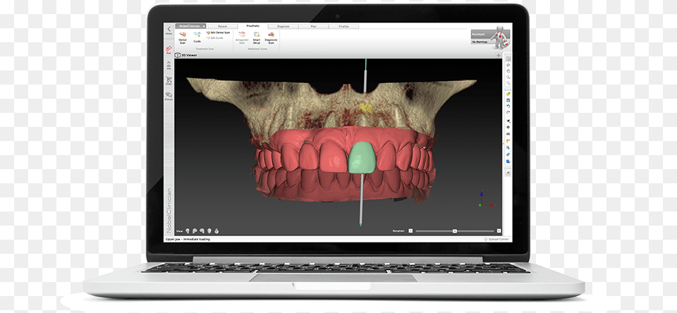 Digital Dentistry Workflow Courses Netbook, Computer, Electronics, Laptop, Pc Free Png Download