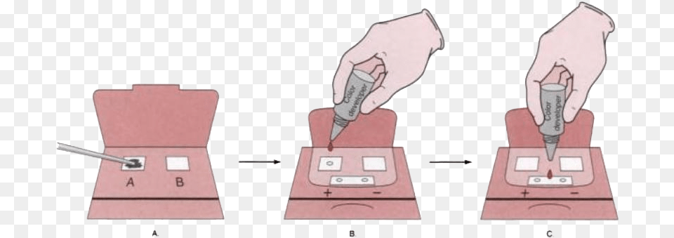 Digital Rectal Exam For Colorectal Cancer, Machine, Screw Png Image