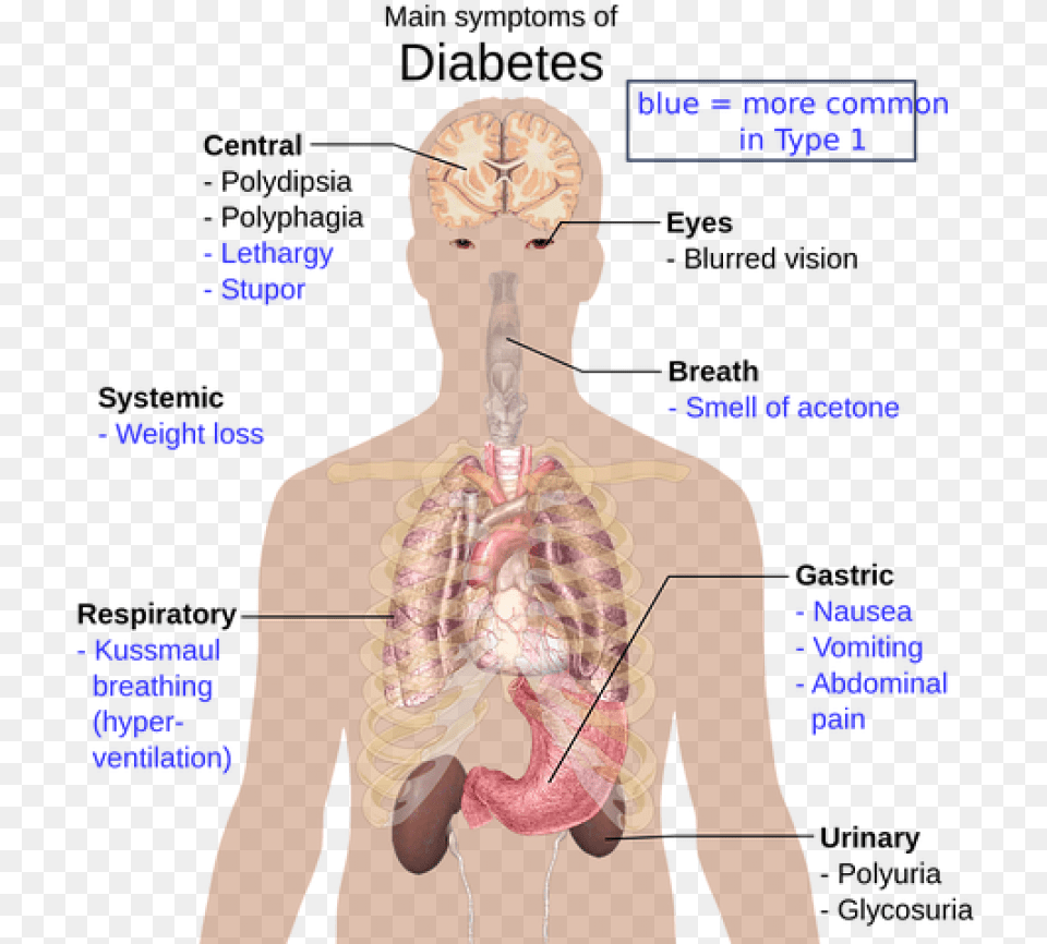 Disease In Organ System, Adult, Female, Person, Woman Free Png