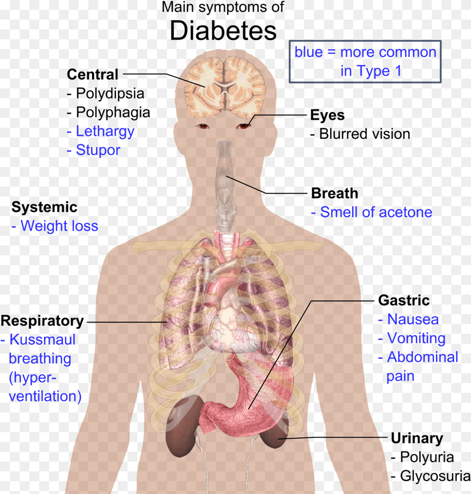 Disease In Organ System, Adult, Male, Man, Person Png