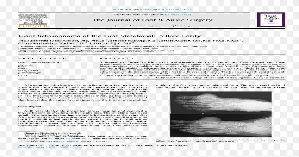 Document, Ct Scan, Finger, Body Part, Person Png