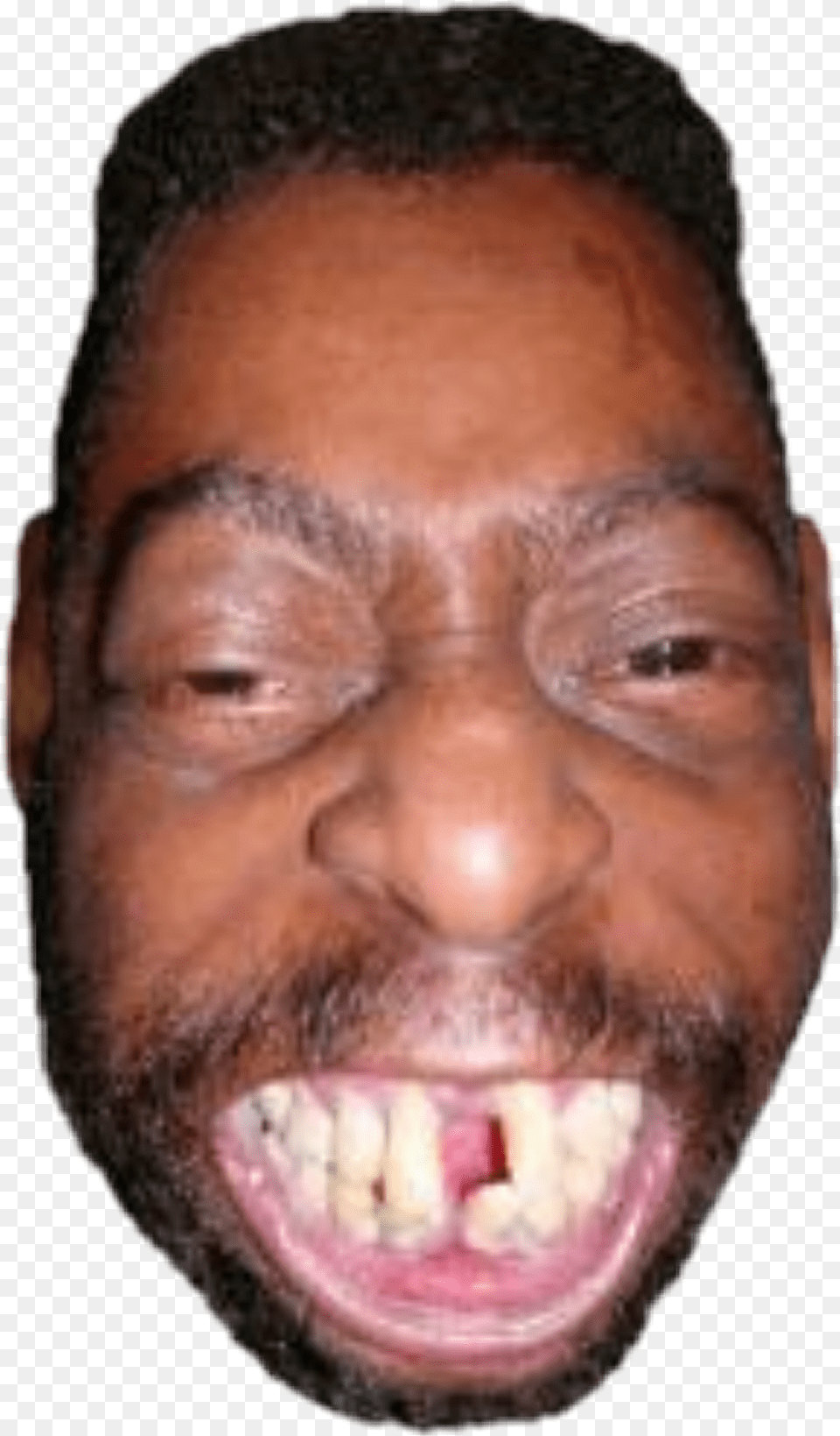 Download Beetlejuice Sticker People With Messed Up Teeth, Body Part, Head, Mouth, Person Free Transparent Png