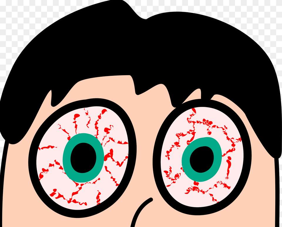 Dry Eye Can Be An Irritating Thing To Live With Dry Eyes Clipart, Head, Person, Face, Animal Free Transparent Png