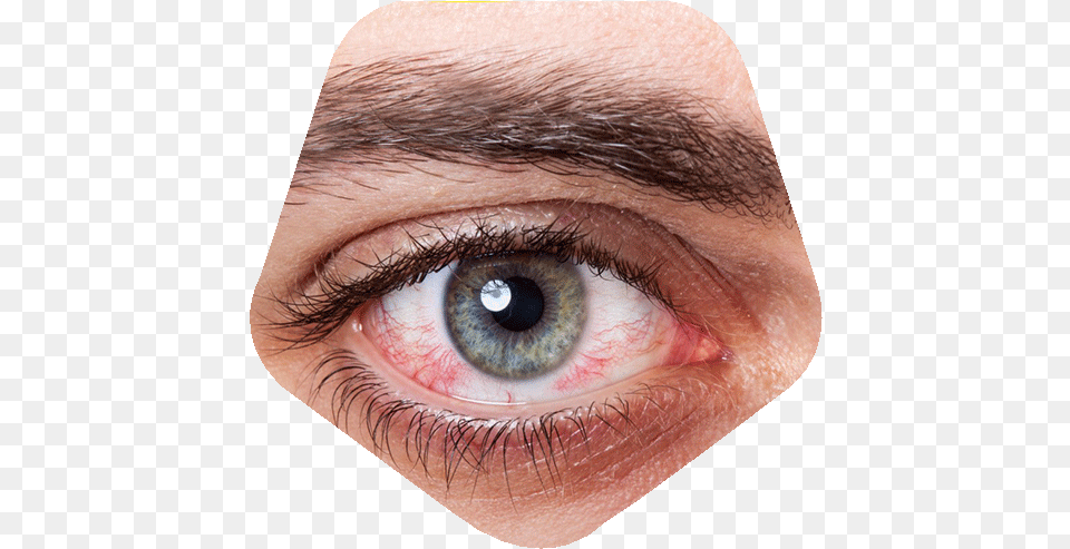 Dry Eyes A Los Ojos Por El Celular, Adult, Male, Man, Person Png Image