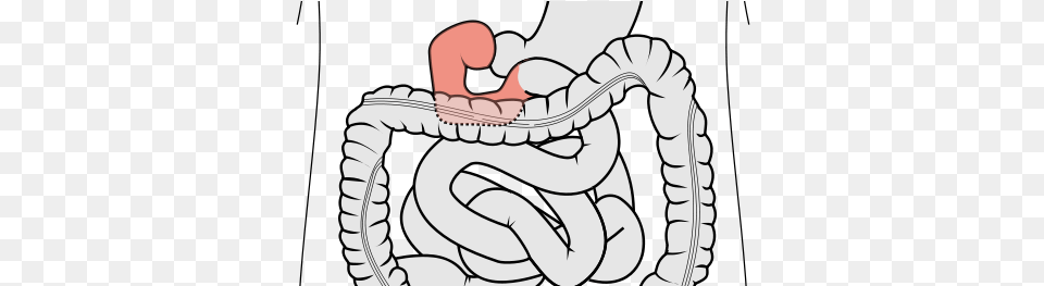 Duodenum Of The Small Intestine Being Squirted, Knot, Baby, Person Free Transparent Png