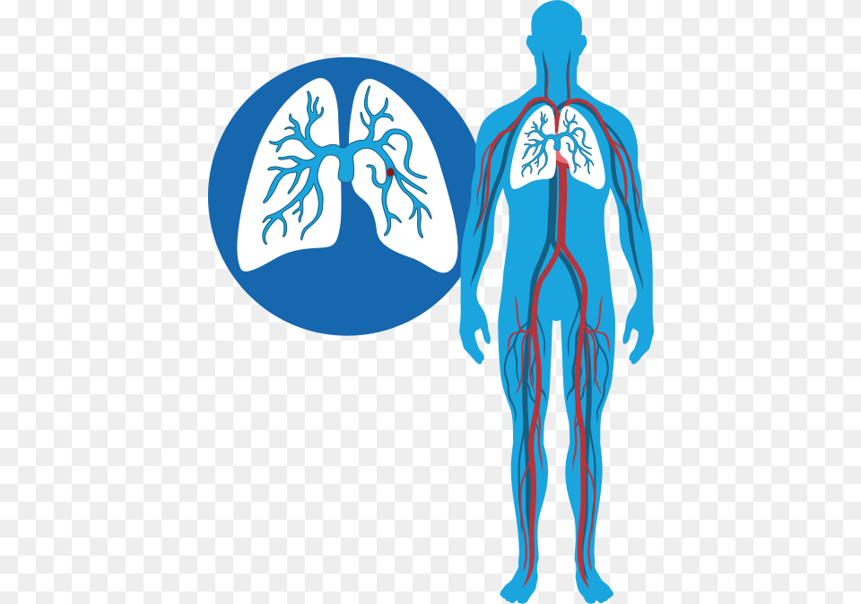 Dvt And Pe Diagram Dvt And Pe, Ct Scan, Adult, Male, Man Png