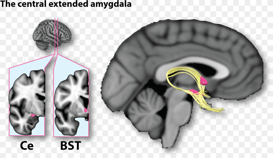 Eac, Ct Scan Free Transparent Png