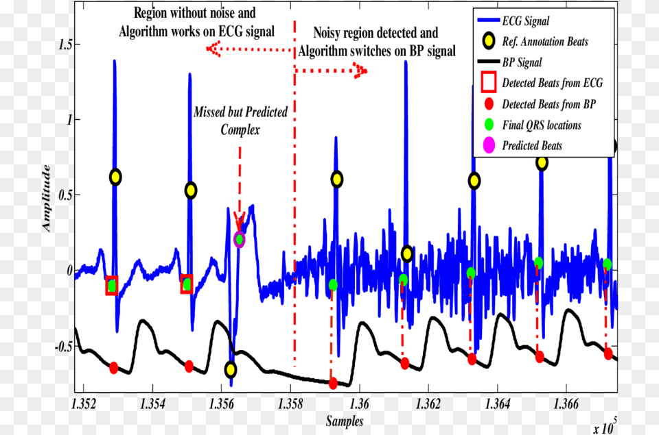 Ecg Heartbeat Detection, Chart, Plot Free Png Download