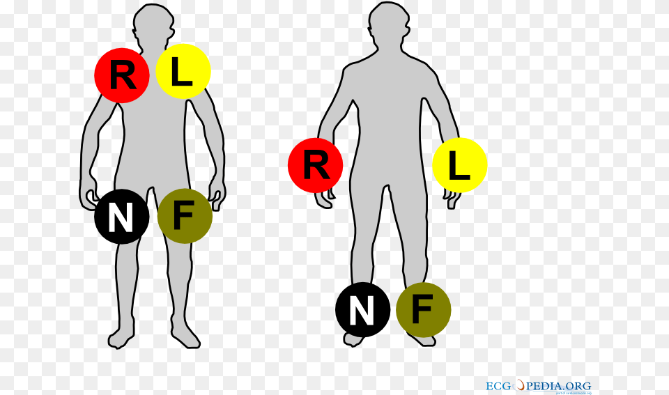 Ecg Limb Leads Colour, Chart, Plot, Adult, Male Png