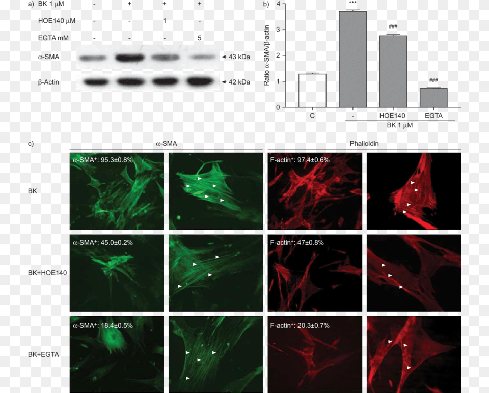Effect Of Bradykinin On Myofibroblast Differentiation F Actin A Sma, Accessories, Pattern Png