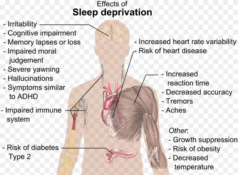 Effect Of Sleep Deprivation Effects Of Sleep Deprivation, Adult, Body Part, Face, Female Png Image