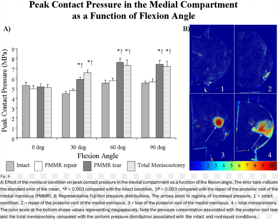 Effect Of The Meniscal Condition Pressure On Meniscus, Chart, Plot Png