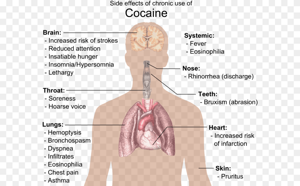 Effects Of Cocaine, Adult, Body Part, Face, Head Free Transparent Png