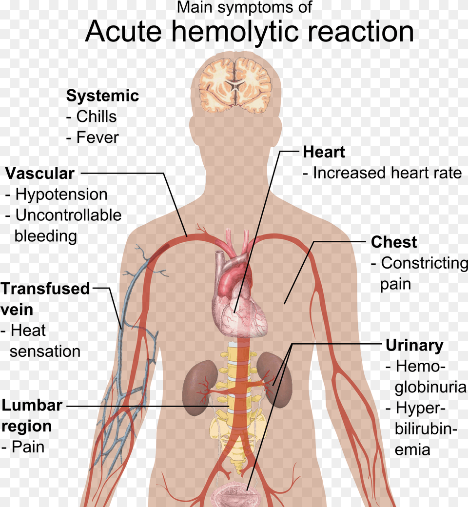 Effects Of Hypothyroidism, Adult, Male, Man, Person Png