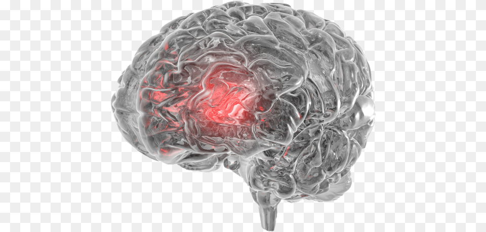 Effects Of Ice On The Brain, Sphere, Ct Scan, Smoke Png