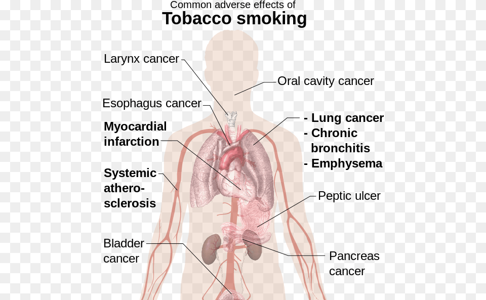 Effects Of Smoking Common Adverse Effects Of Tobacco Smoking, Adult, Male, Man, Person Free Png