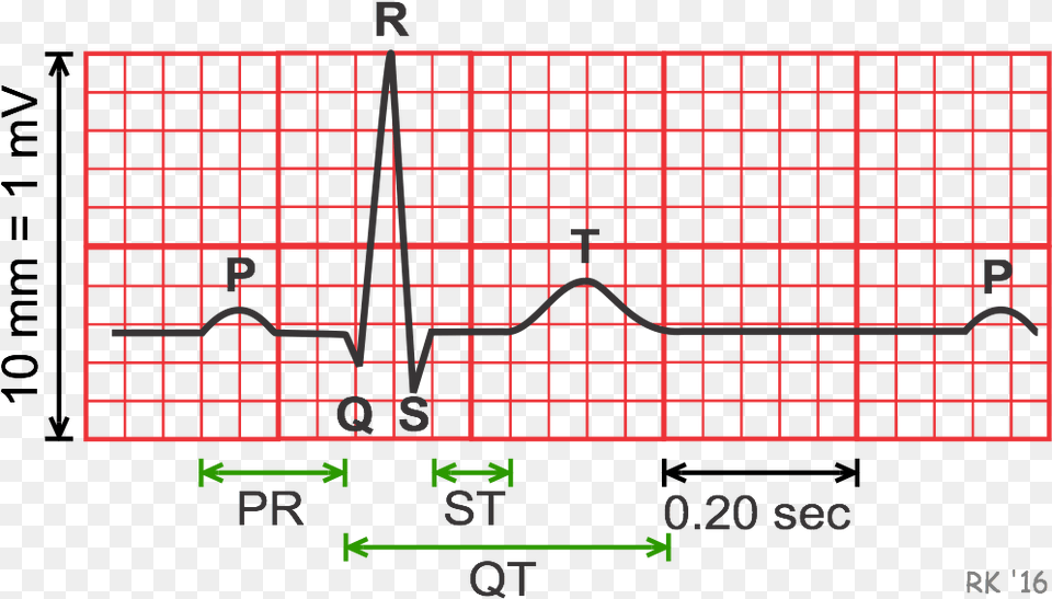 Electrocardiogram Durations And Intervals Ecg Duration, Blackboard Png Image