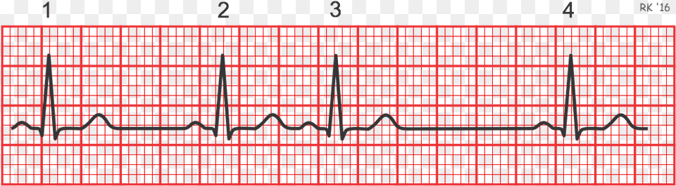 Electrocardiogram Rhythm Strip Irregular Heart Rate Ecg, Scoreboard, Computer Hardware, Electronics, Hardware Free Png