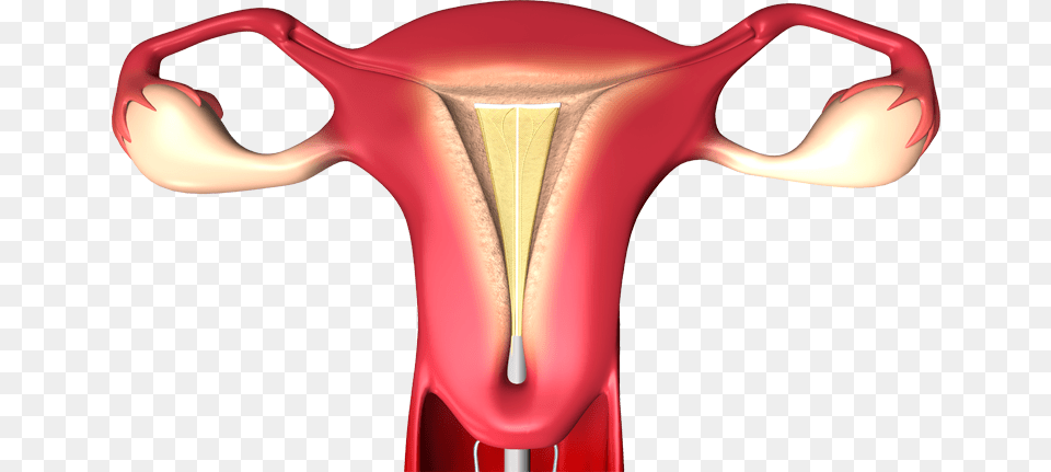Endometrial Ablation, Body Part, Face, Head, Neck Free Png