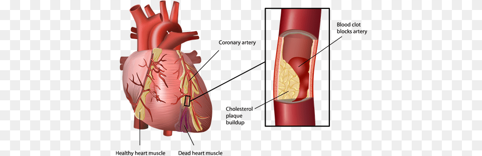 Enlisting Stem Cells In The War Oral Health And Heart Disease, Dynamite, Weapon, Body Part, Person Free Png