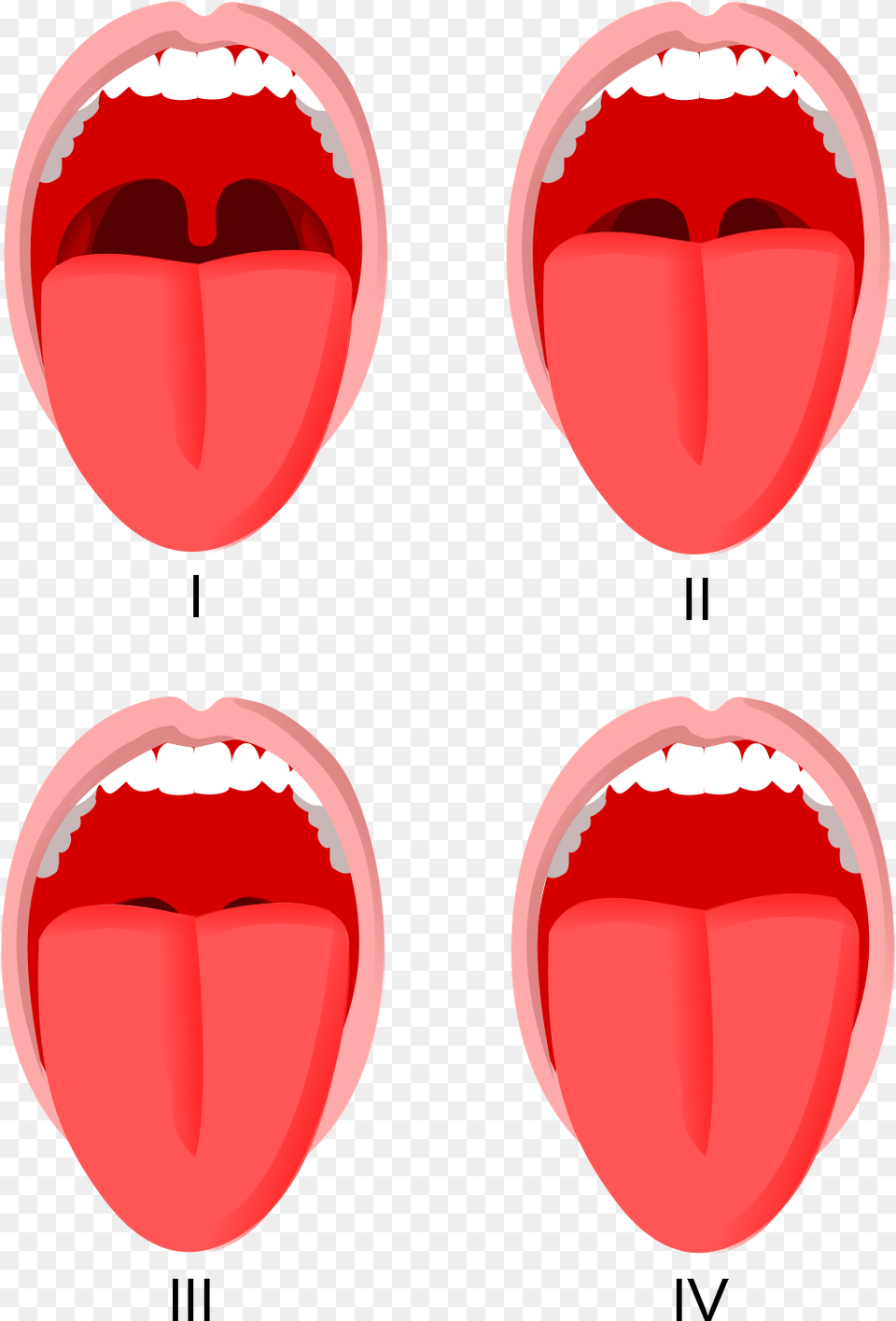 Escala De Mallampati Modificada, Body Part, Mouth, Person, Tongue Png Image
