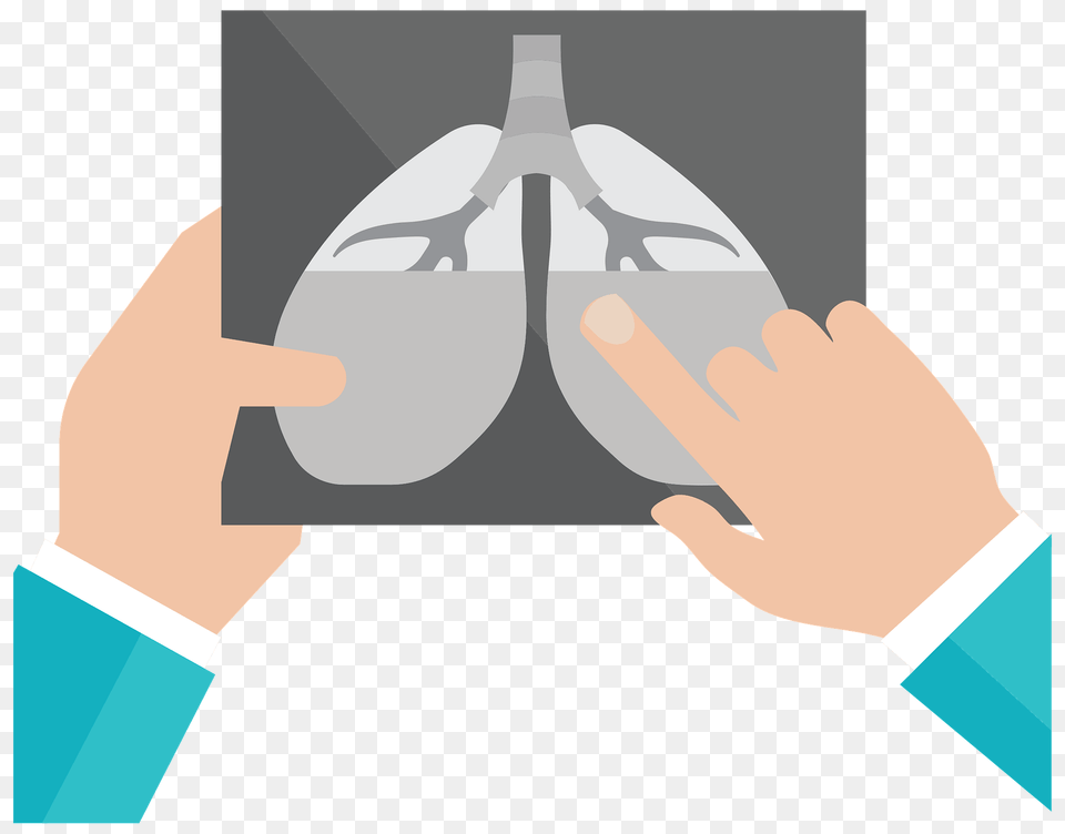 Examining An X Ray Of The Lungs Clipart, Photography, Body Part, Hand, Person Png Image