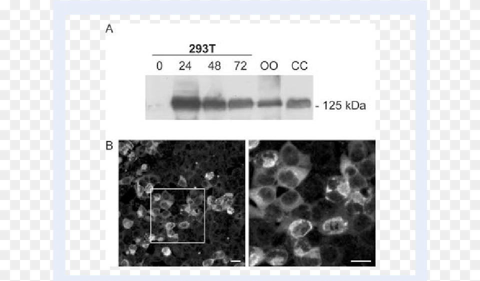 Expression Vector Containing Full Length Mater Was Hek 293 Cells Png