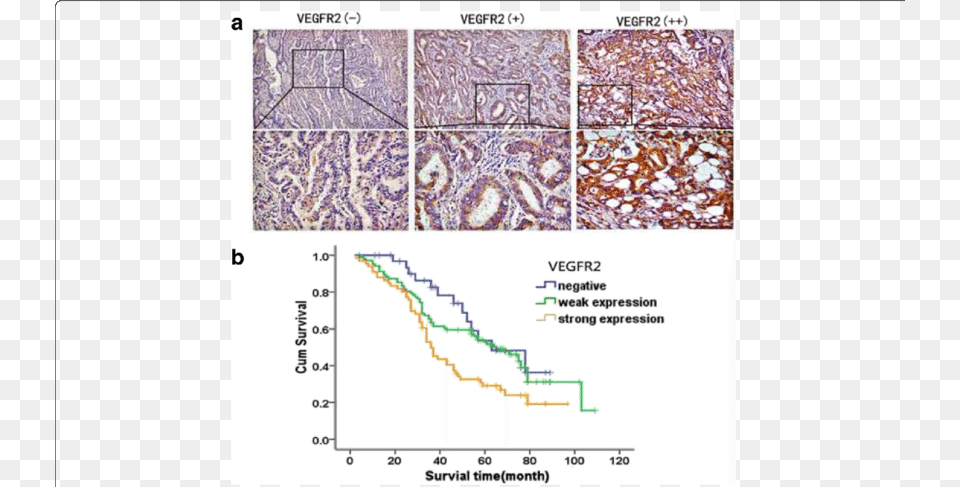 Expressions Of Vegfr2 In Colon Cancer Samles And Kaplan Map, Chart Free Transparent Png