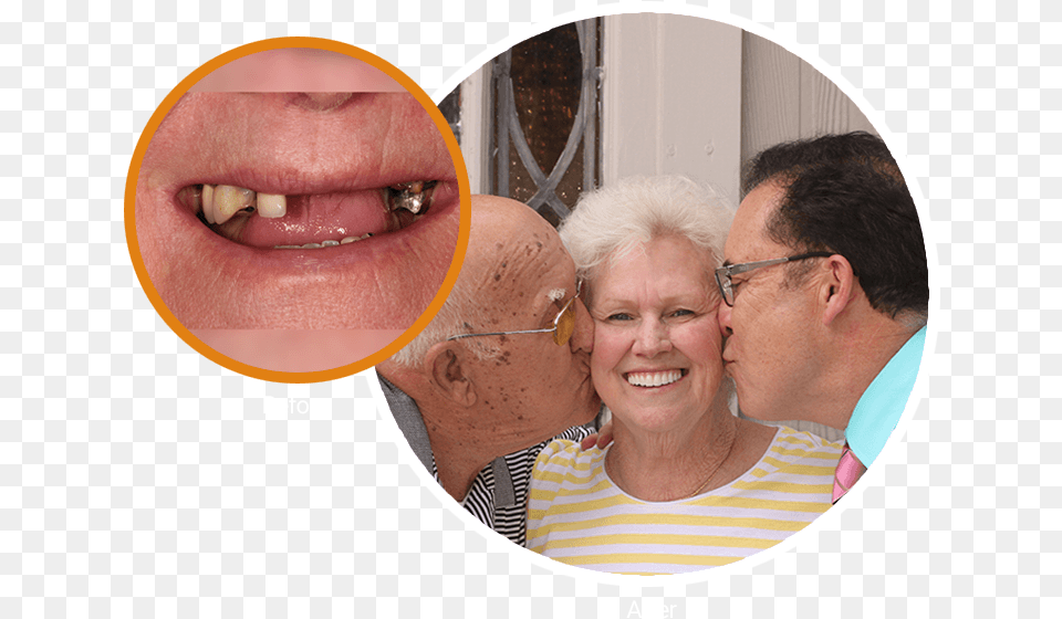 Extreme Close Up Of Sue S Smile And Then Next To It Fun, Teeth, Body Part, Person, Mouth Png
