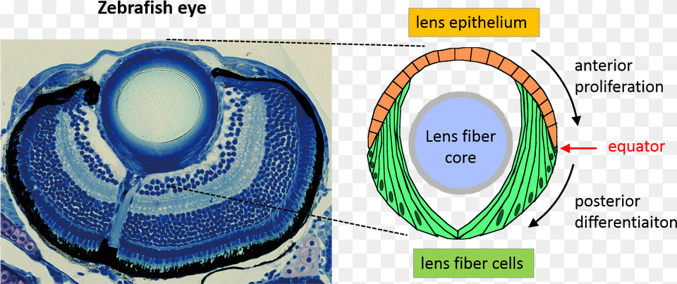 Eye Lense, Ct Scan, Accessories Free Png Download