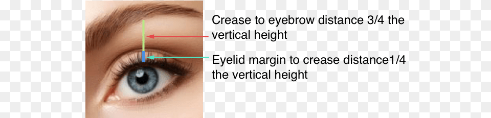 Eye Lift Women Diagram Eyelid, Baby, Person, Contact Lens, Face Png