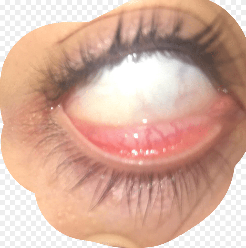 Eye Veins Goth Freetoedit Close Up, Baby, Person, Body Part, Mouth Png