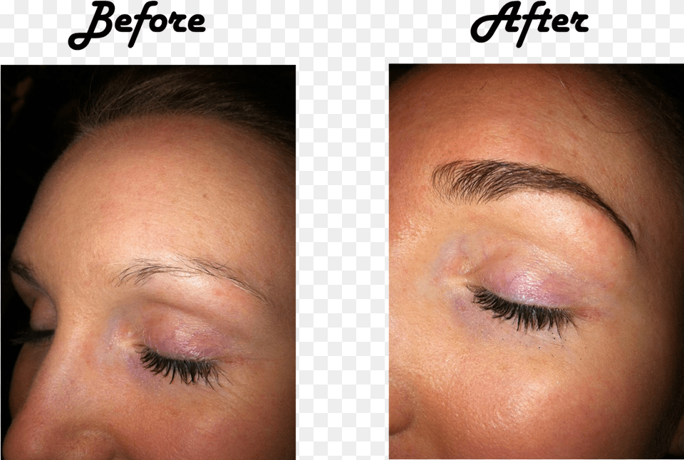 Eyebrow Prp Treatment For Eyebrows, Art, Collage, Head, Person Free Png Download