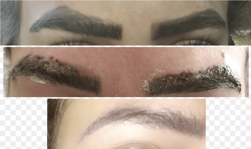 Eyebrow Tattoo Removal Process, Face, Head, Person, Adult Free Png