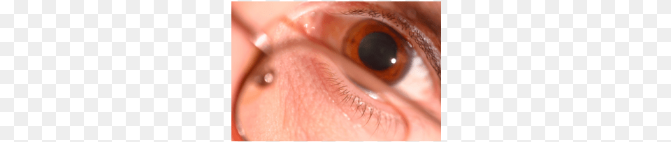 Eyes Pupil Dilation Mydriasis, Baby, Person, Contact Lens Free Transparent Png