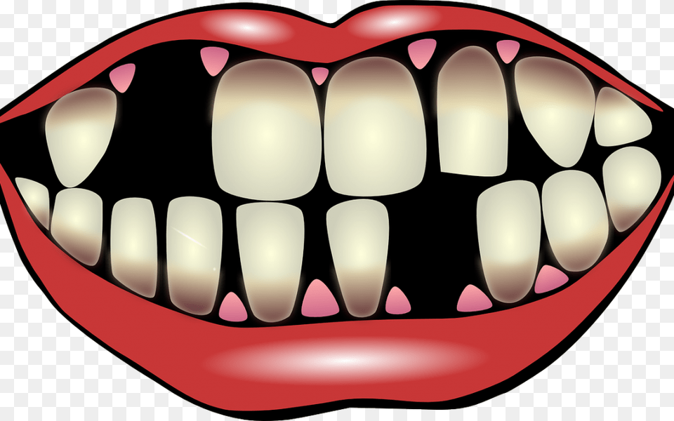 Factors For Losing Your Teeth Port Pediatric Dentistry, Body Part, Mouth, Person, Accessories Png