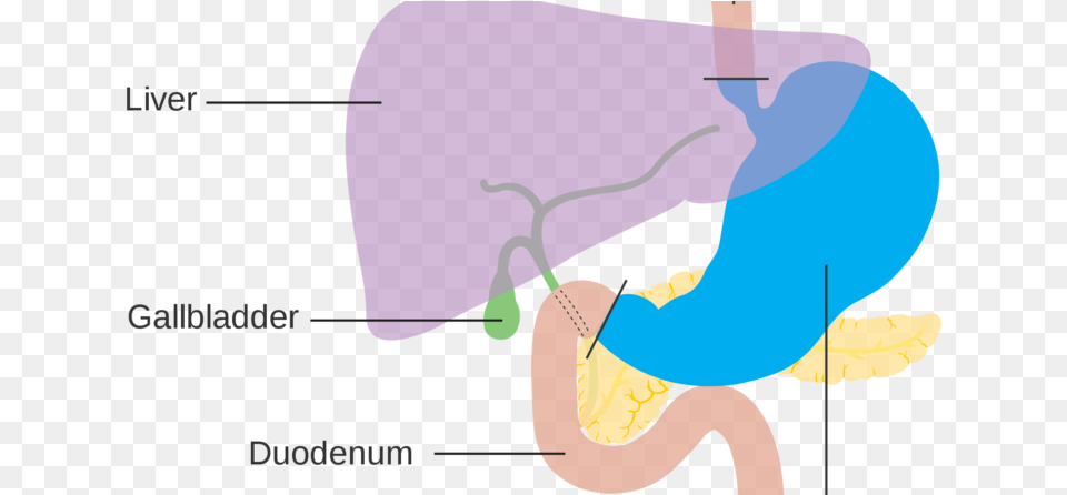 Facts About Stomach Cancer Graphic Design, Baby, Person, Clothing, Hat Png